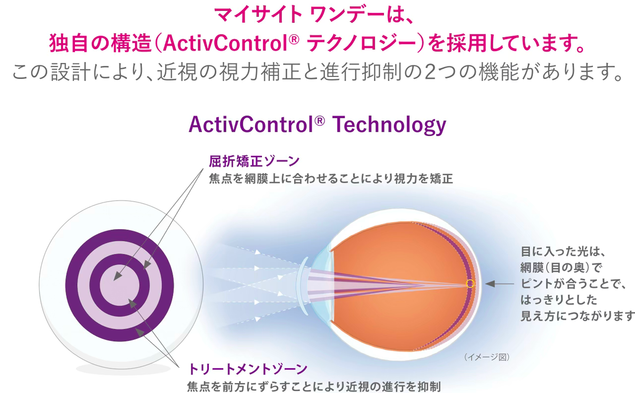 ActivControl Technology の仕組み